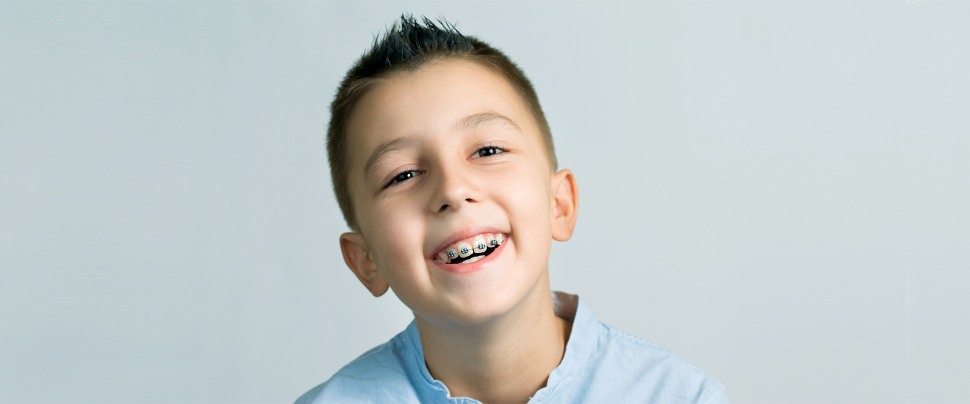 A Clear Alternative to Traditional Braces