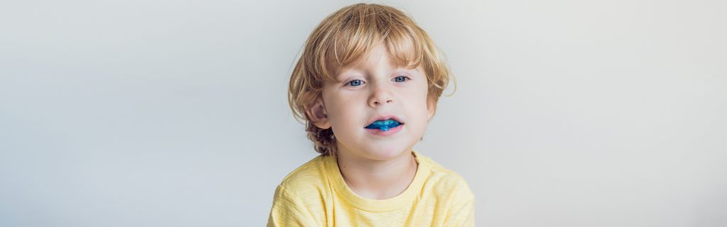 What-Are-Mouthguards-and-What-Do-They-Do