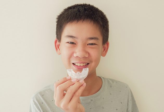 Mouth-Guards111