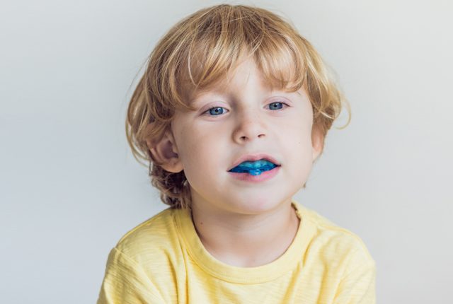 What-Are-Mouthguards-and-What-Do-They-Do